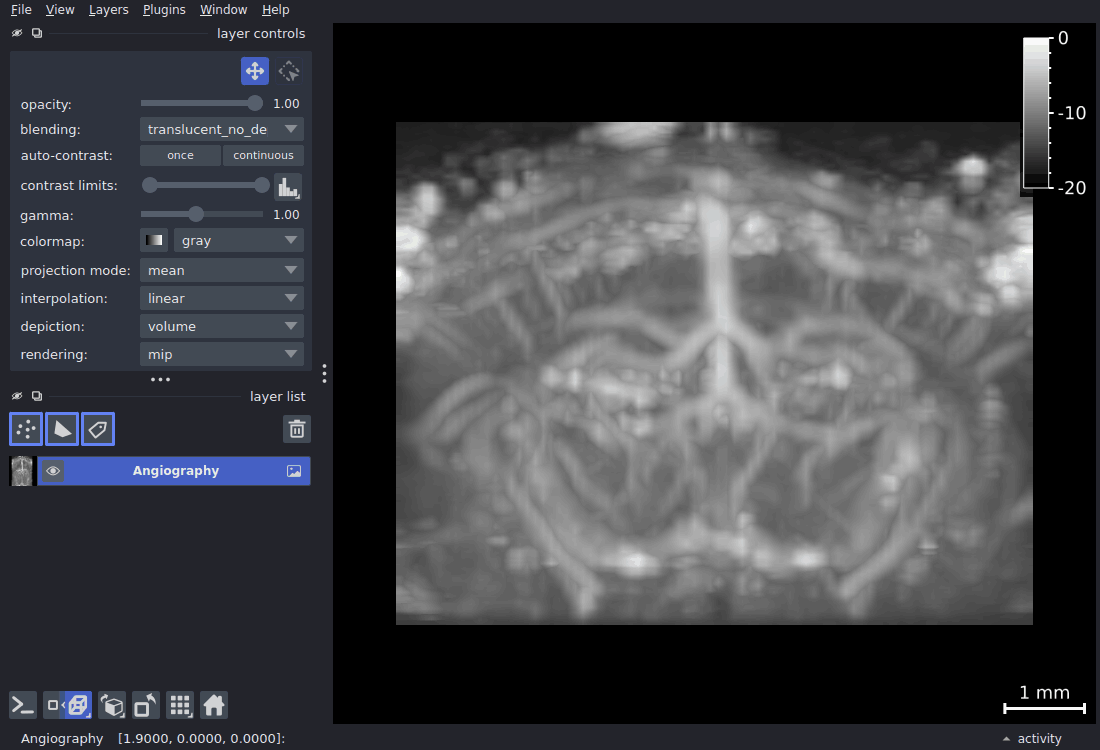 3D orbit of the angiography volume