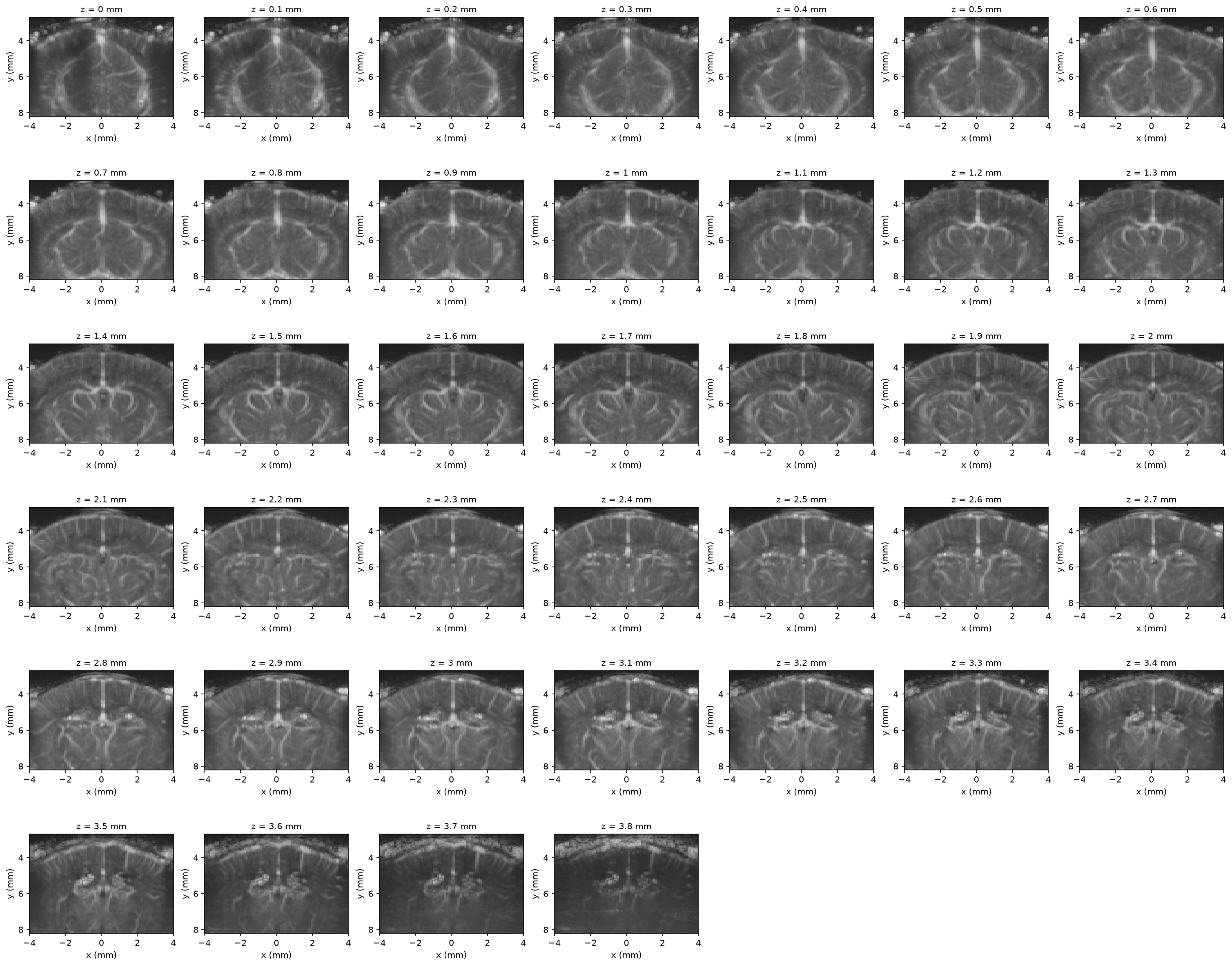 3D angiography volume shown as an elevation-slice grid