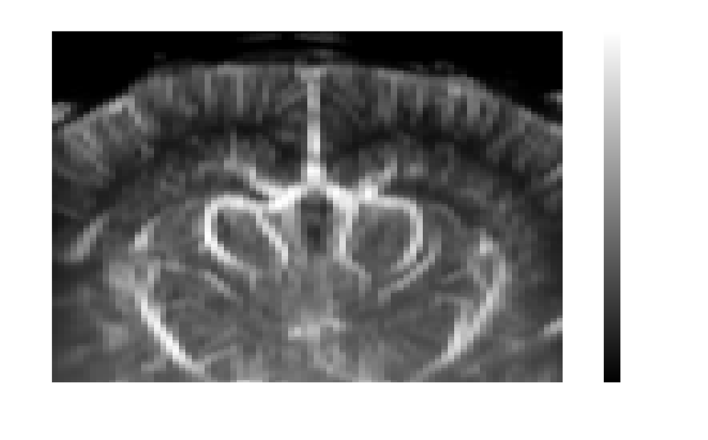Mean power Doppler volume