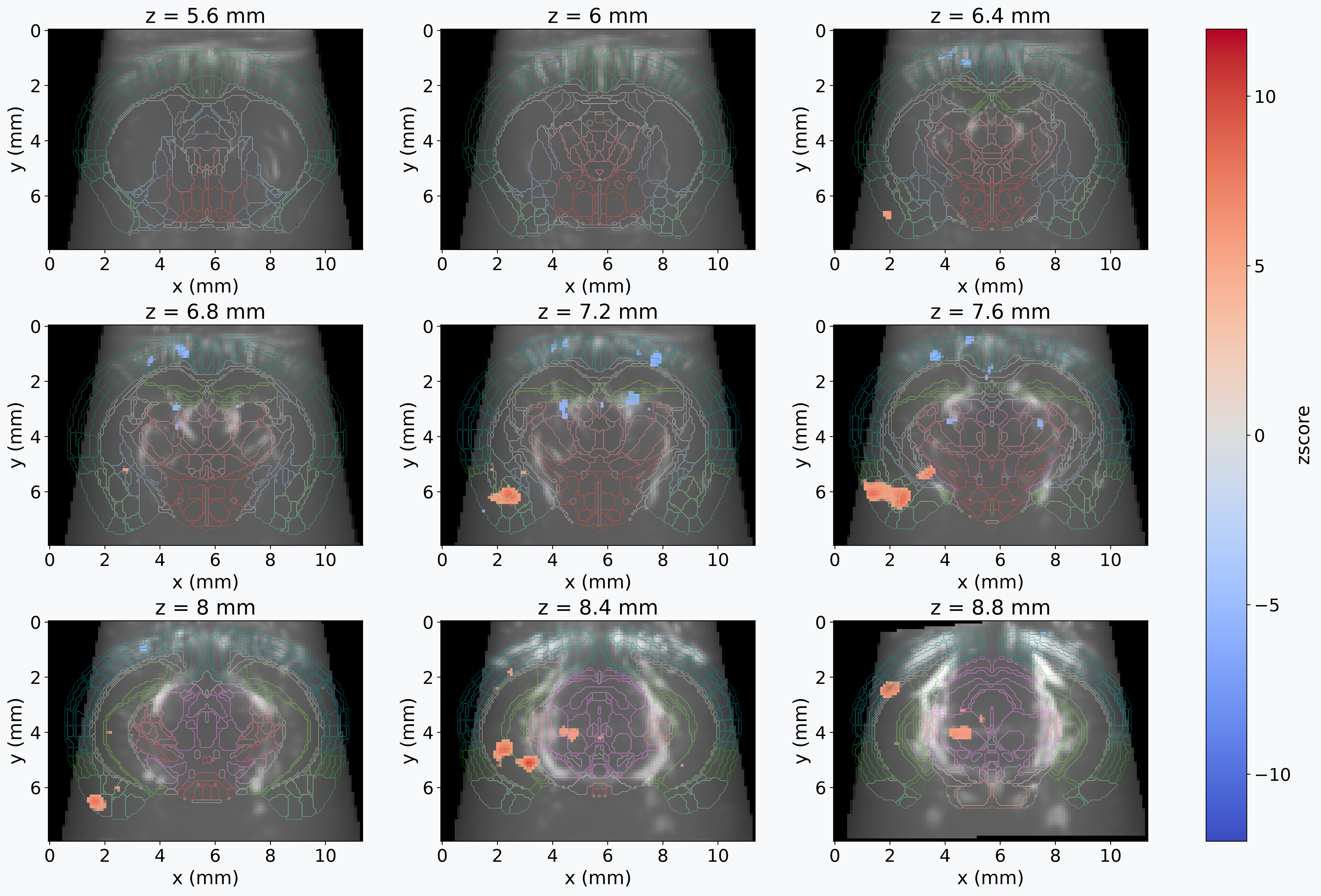 First-level GLM analysis of fUSI data