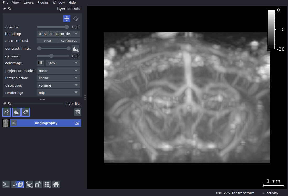 3D orbit of the angiography volume