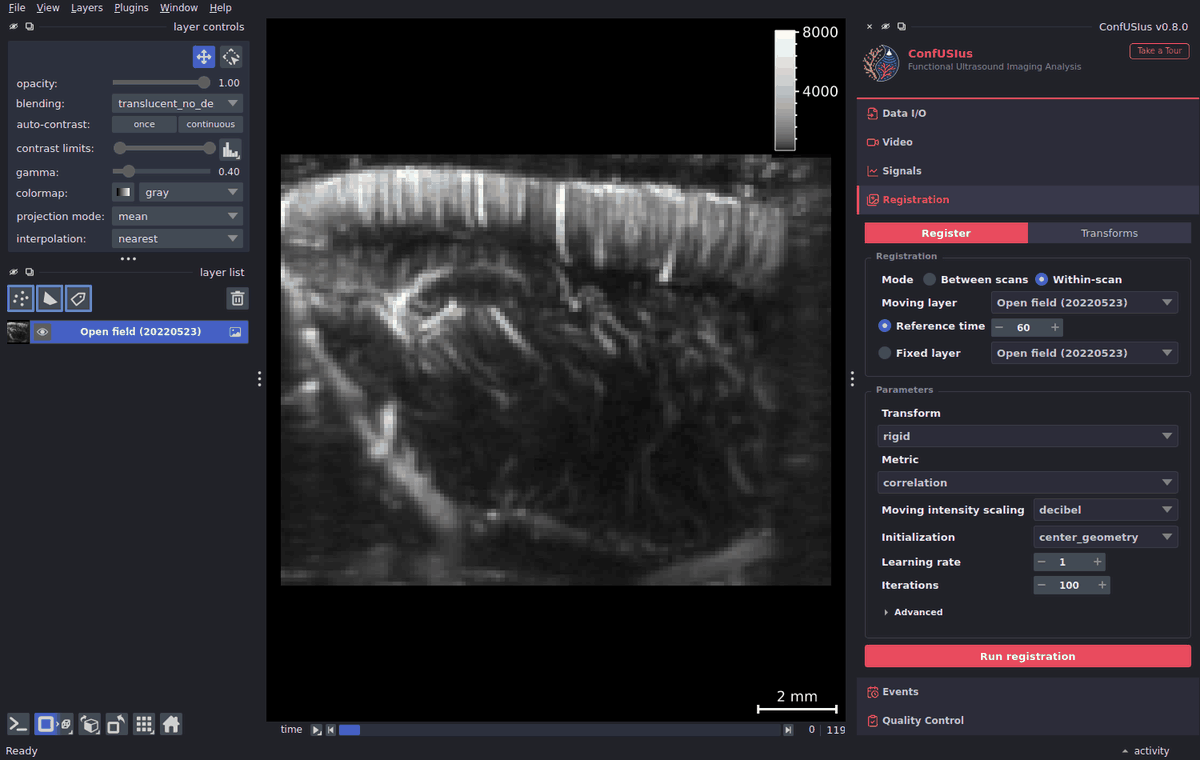 ConfUSIus Registration panel — within-scan motion correction