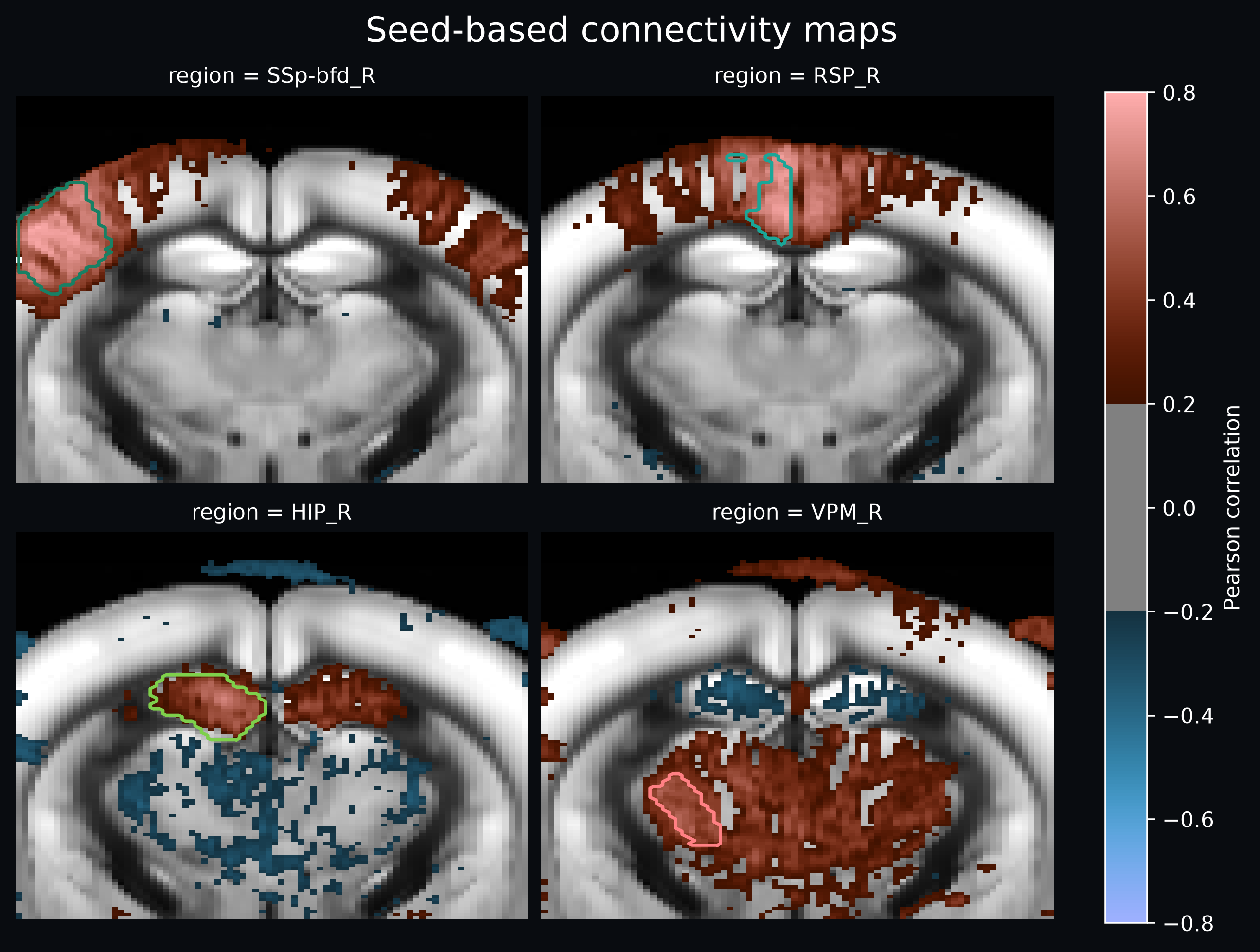 Atlas-based seed connectivity maps