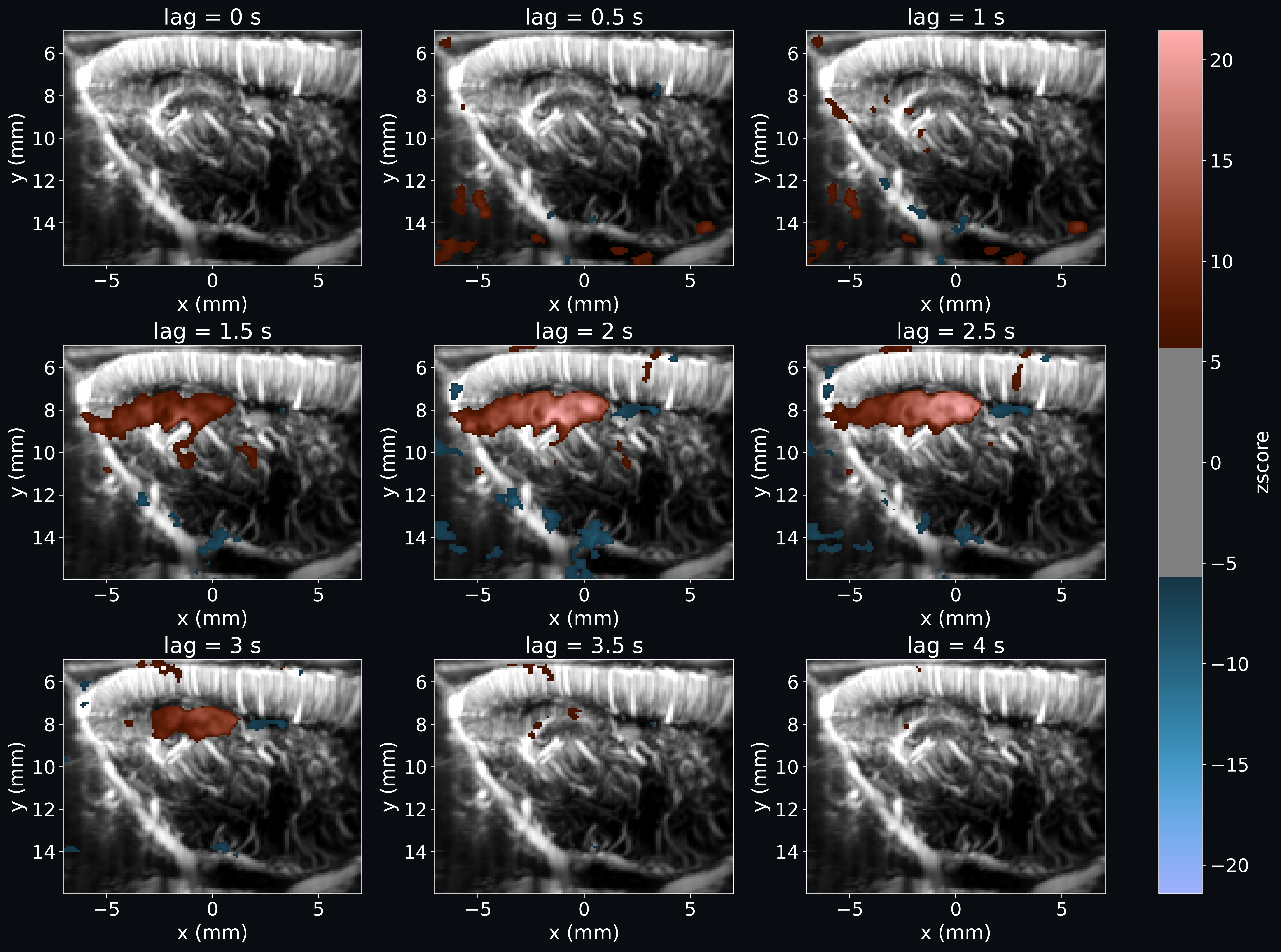 Lagged first-level GLM analysis of fUSI data with a continuous regressor
