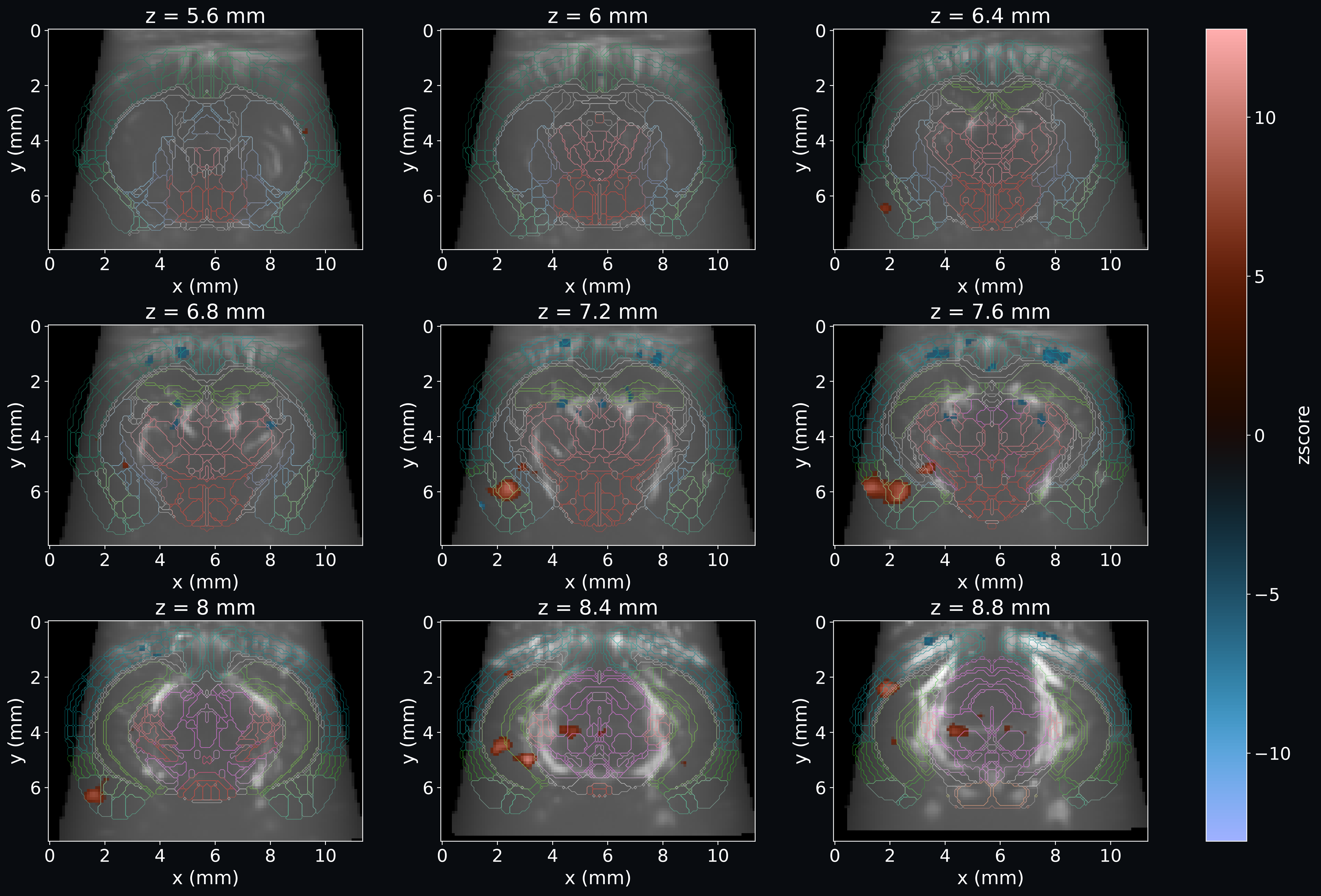 First-level GLM analysis of fUSI data