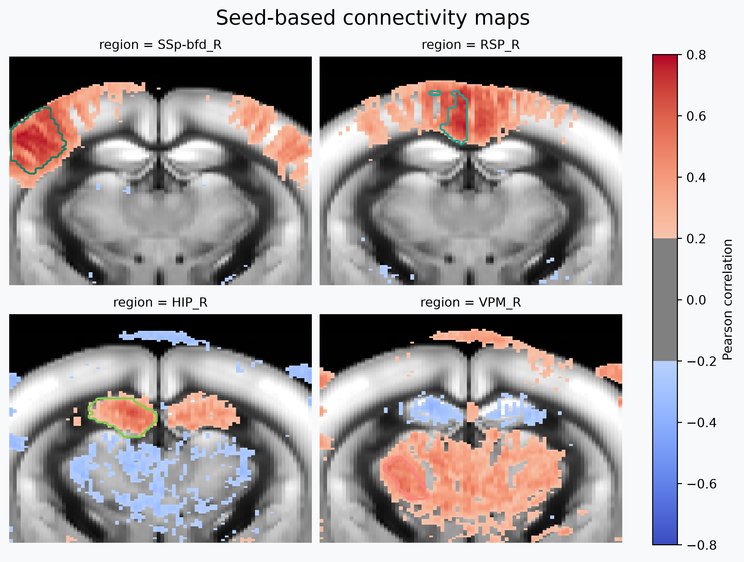 Atlas-based seed connectivity maps