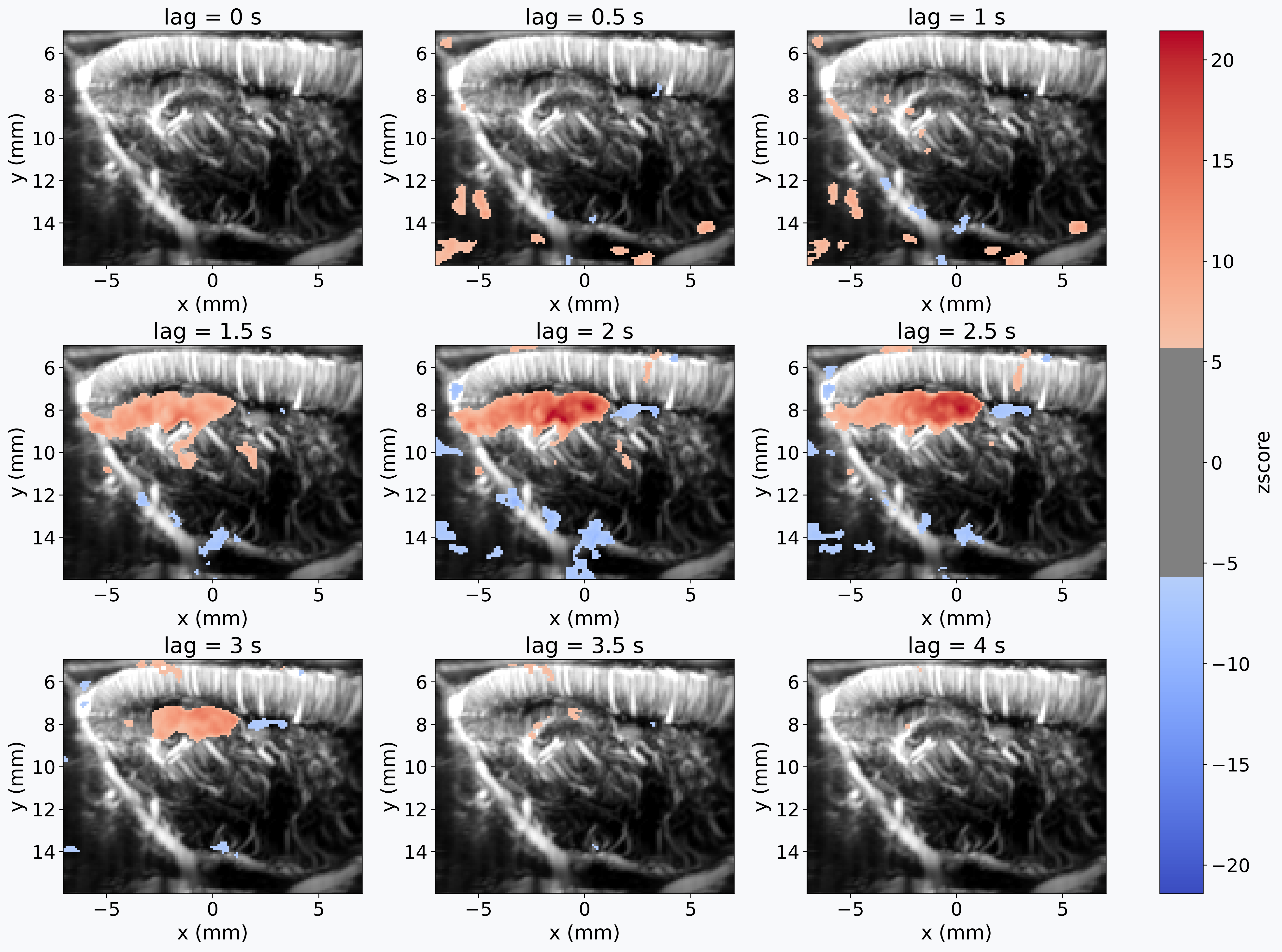 Lagged first-level GLM analysis of fUSI data with a continuous regressor