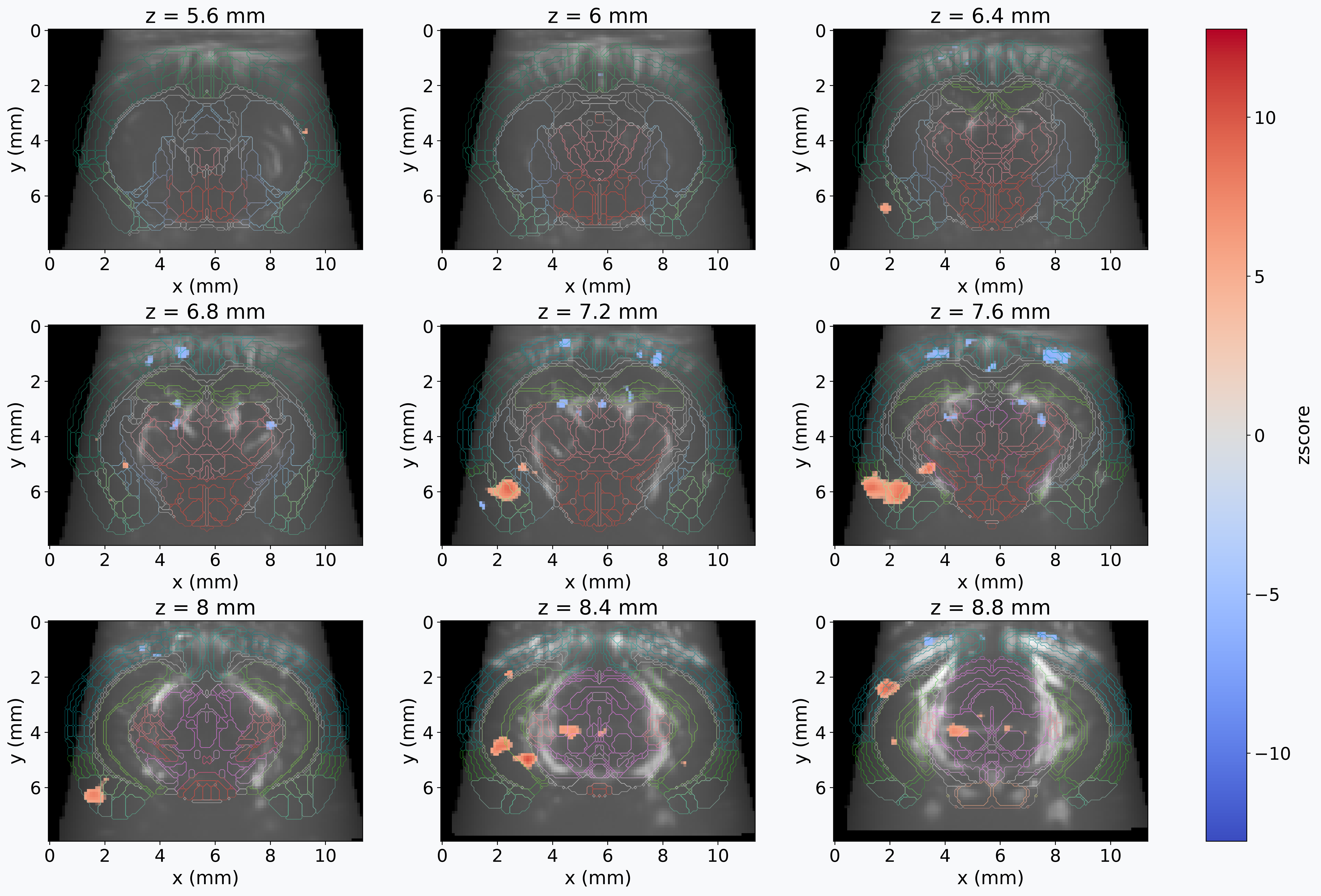 First-level GLM analysis of fUSI data