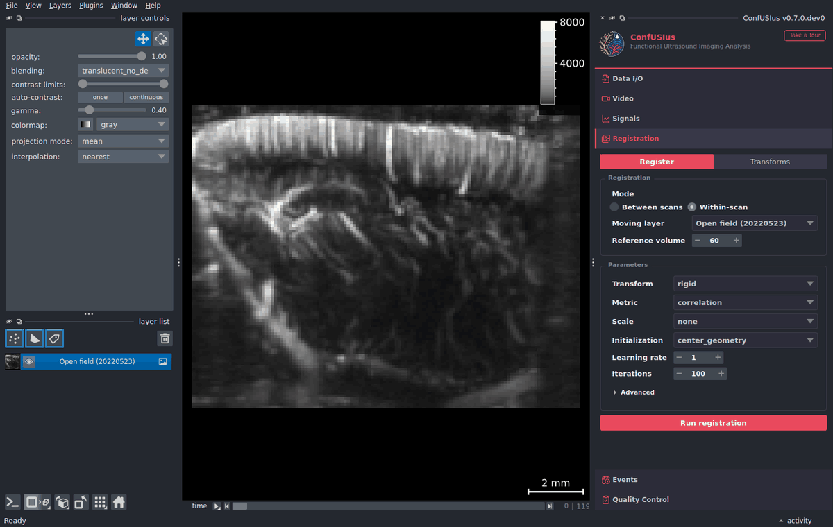 ConfUSIus Registration panel — within-scan motion correction
