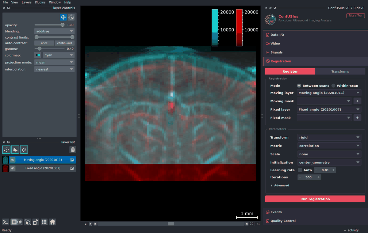 ConfUSIus Registration panel — rigid between-session angiography run