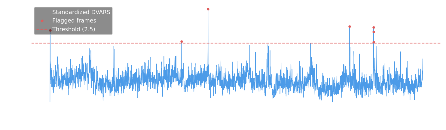 DVARS time series with threshold