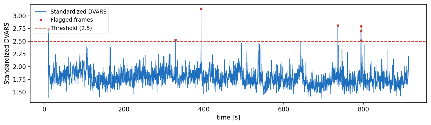 DVARS time series with threshold