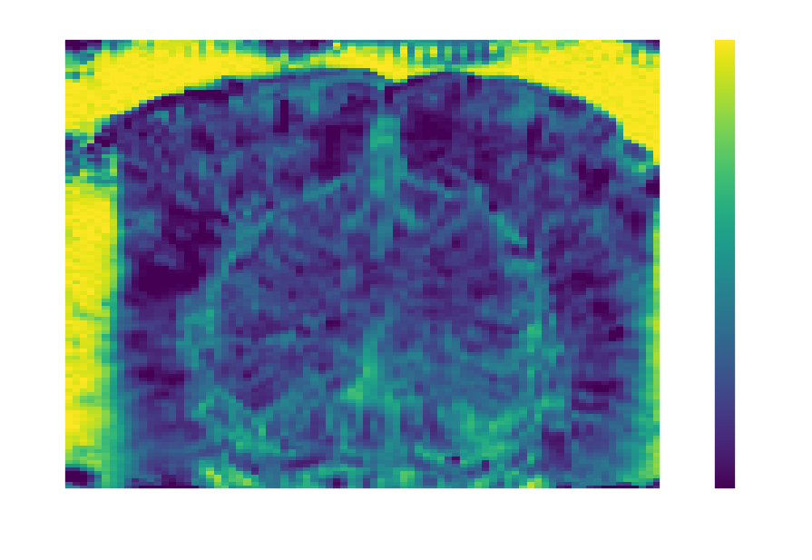 tSNR spatial map