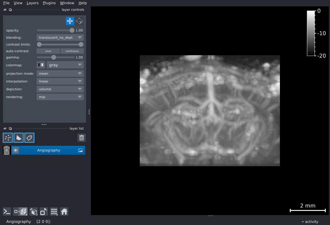 3D orbit of the angiography volume