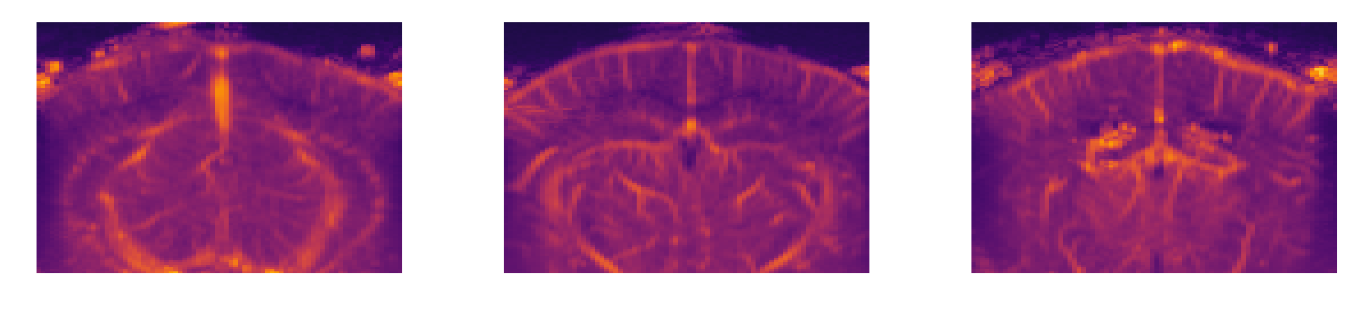 Three selected elevation slices of the angiography volume
