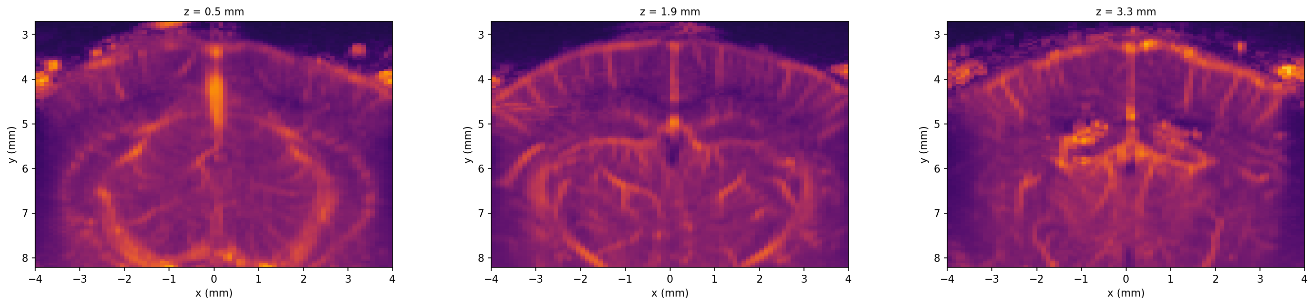 Three selected elevation slices of the angiography volume