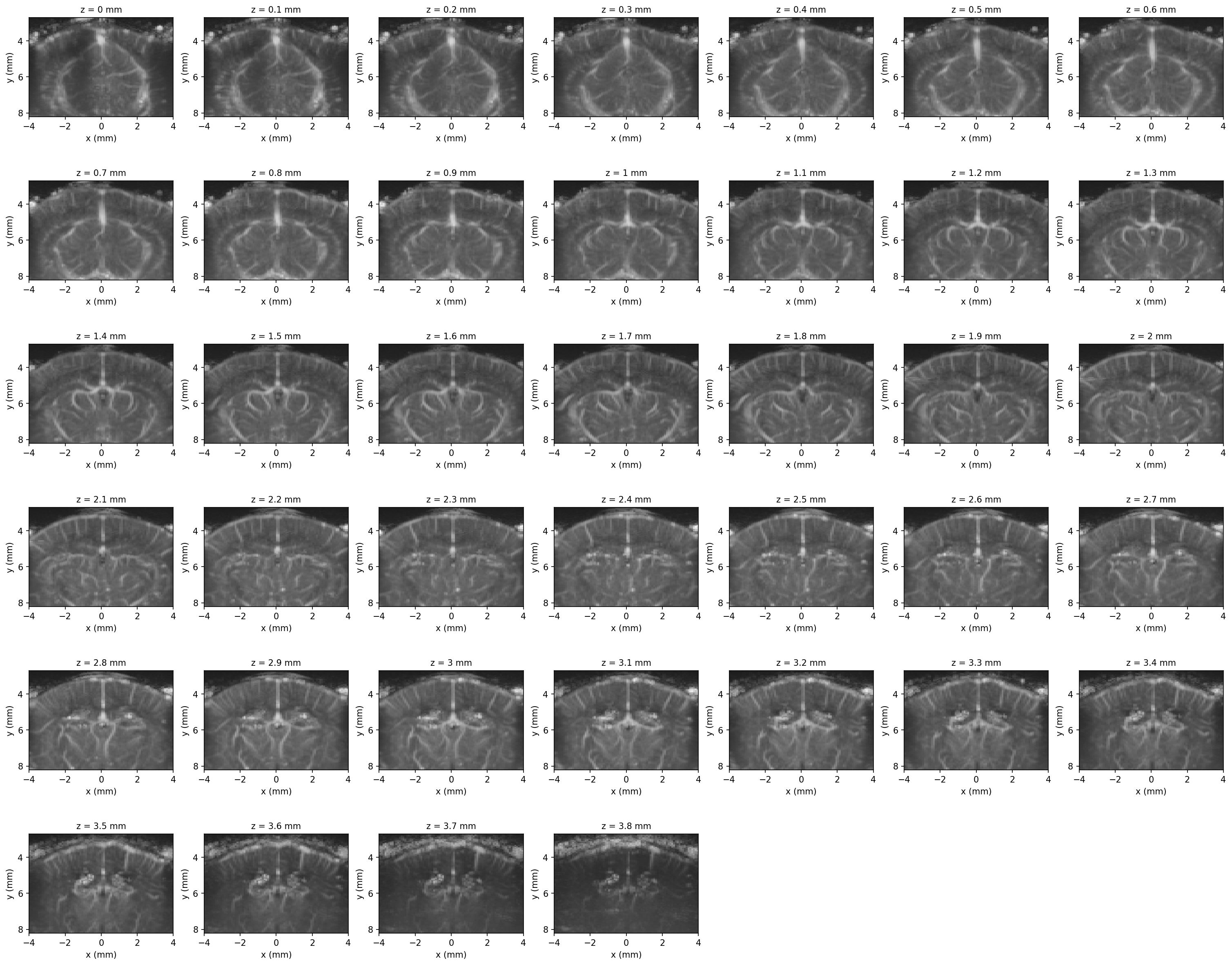 3D angiography volume shown as an elevation-slice grid