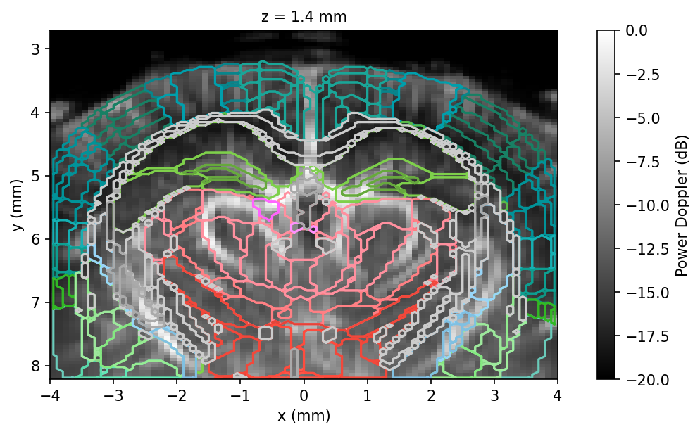 Power Doppler volume with Allen atlas region contours overlaid