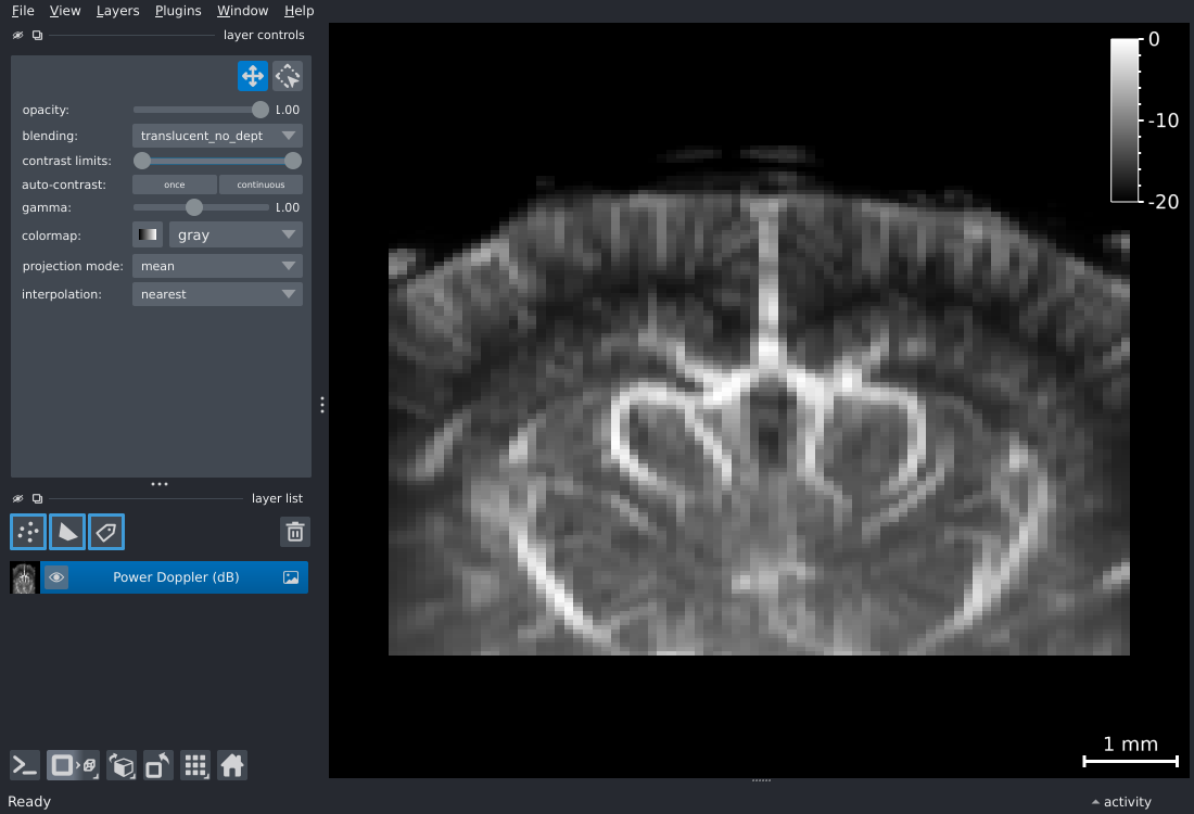 napari viewer with a 2D+t power Doppler dataset