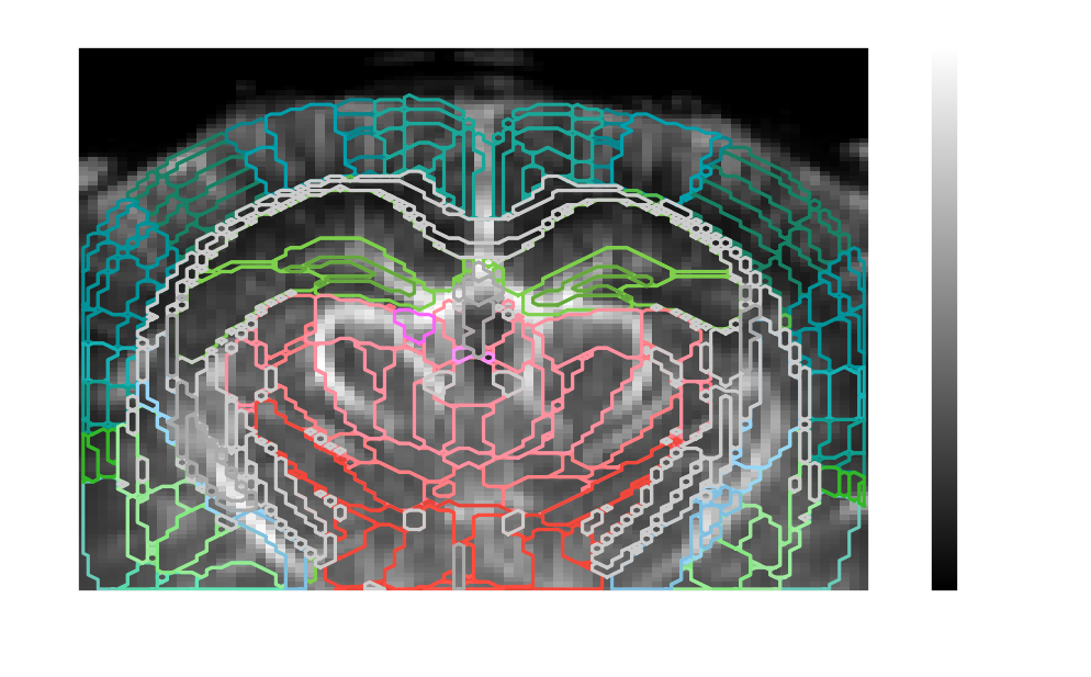 Power Doppler volume with Allen atlas region contours overlaid