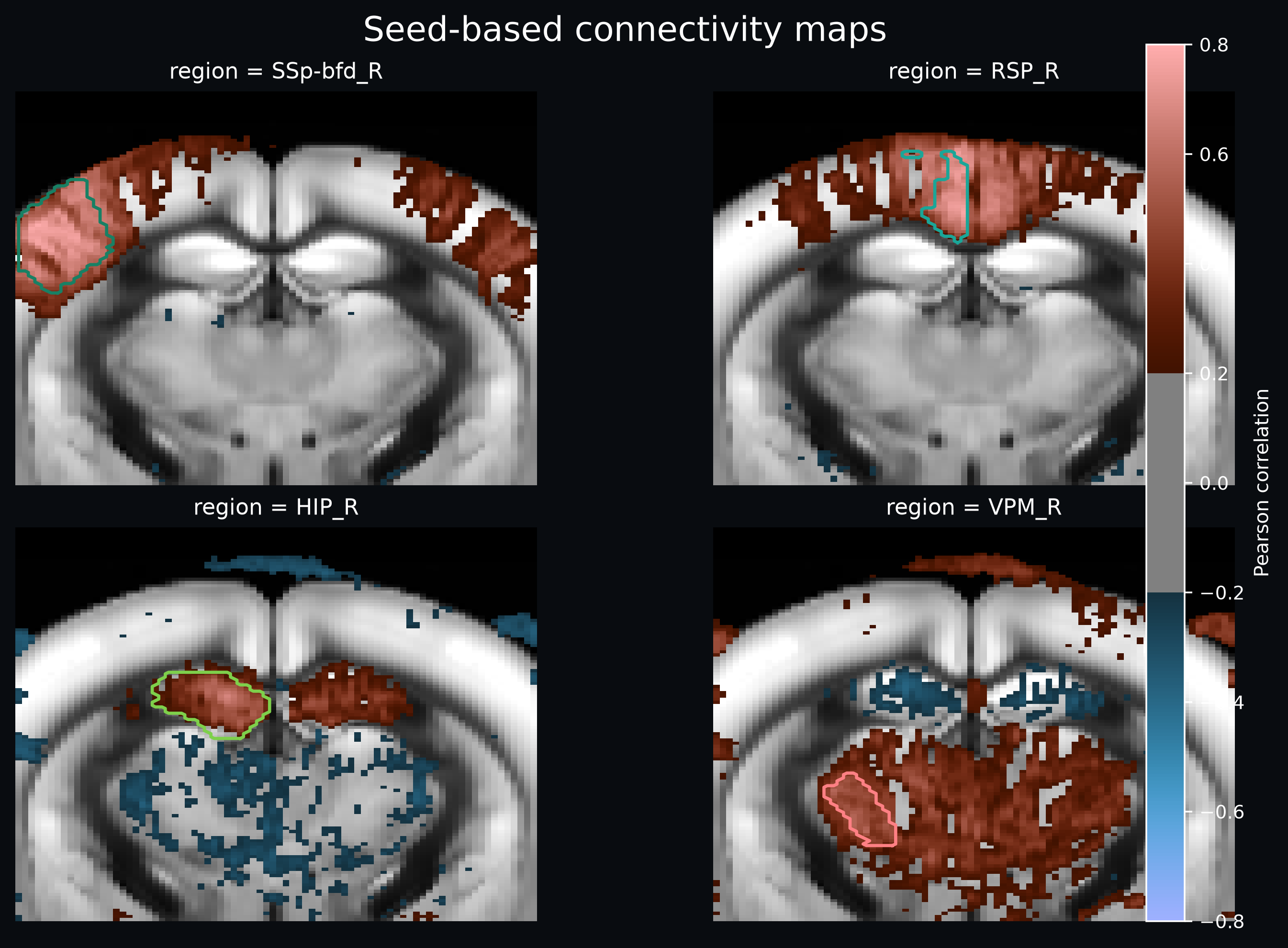 Atlas-based seed connectivity maps
