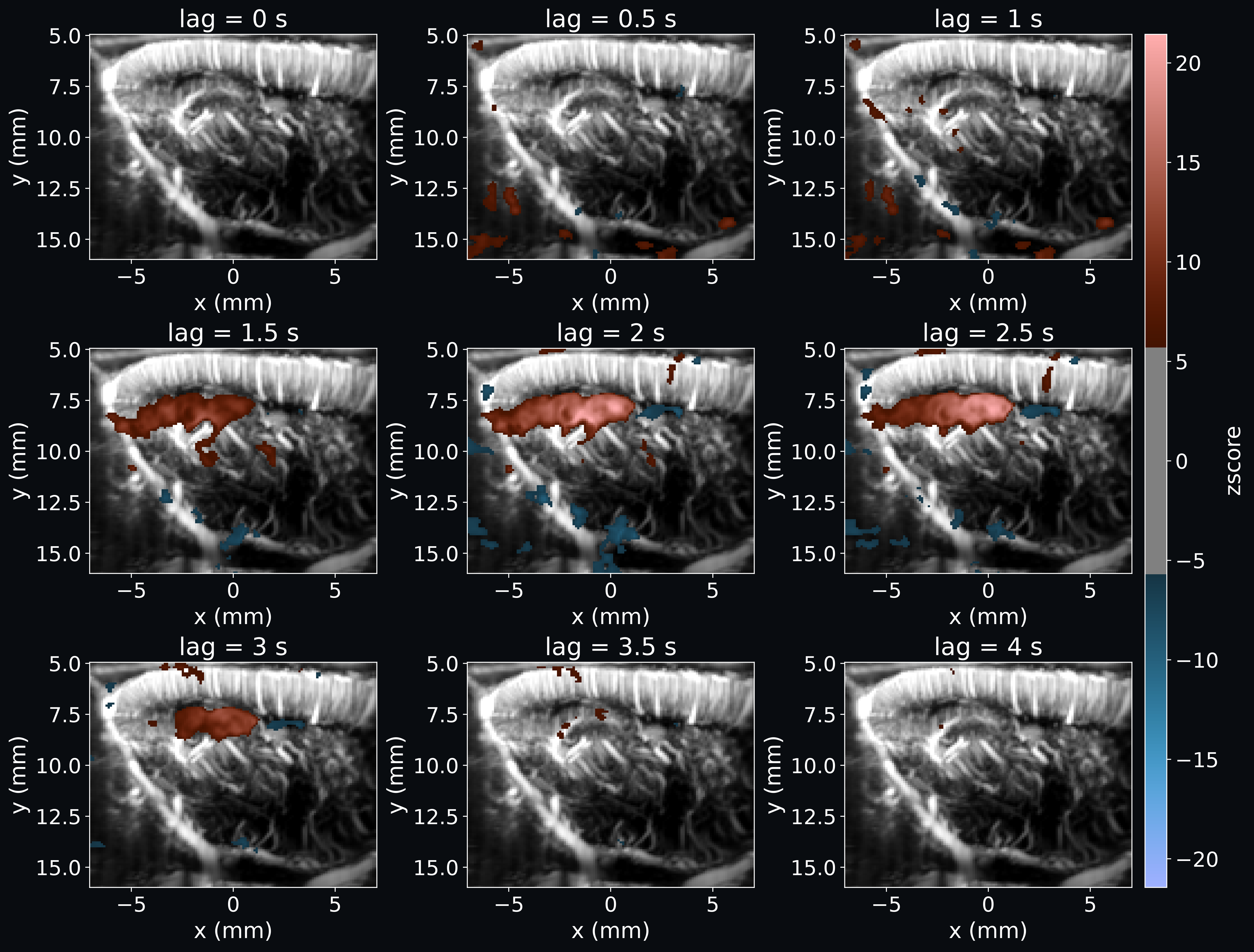 Lagged first-level GLM analysis of fUSI data with a continuous regressor