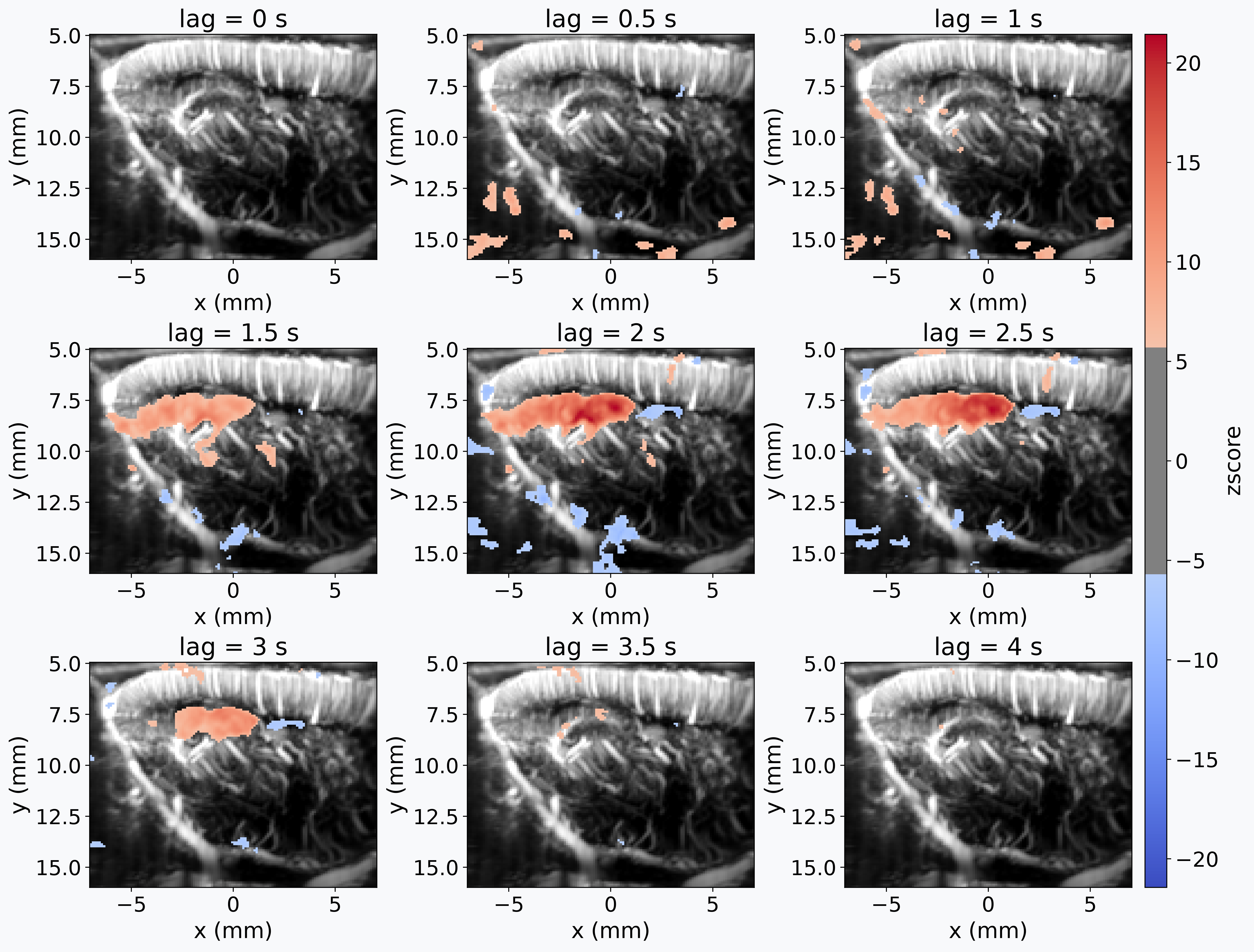 Lagged first-level GLM analysis of fUSI data with a continuous regressor
