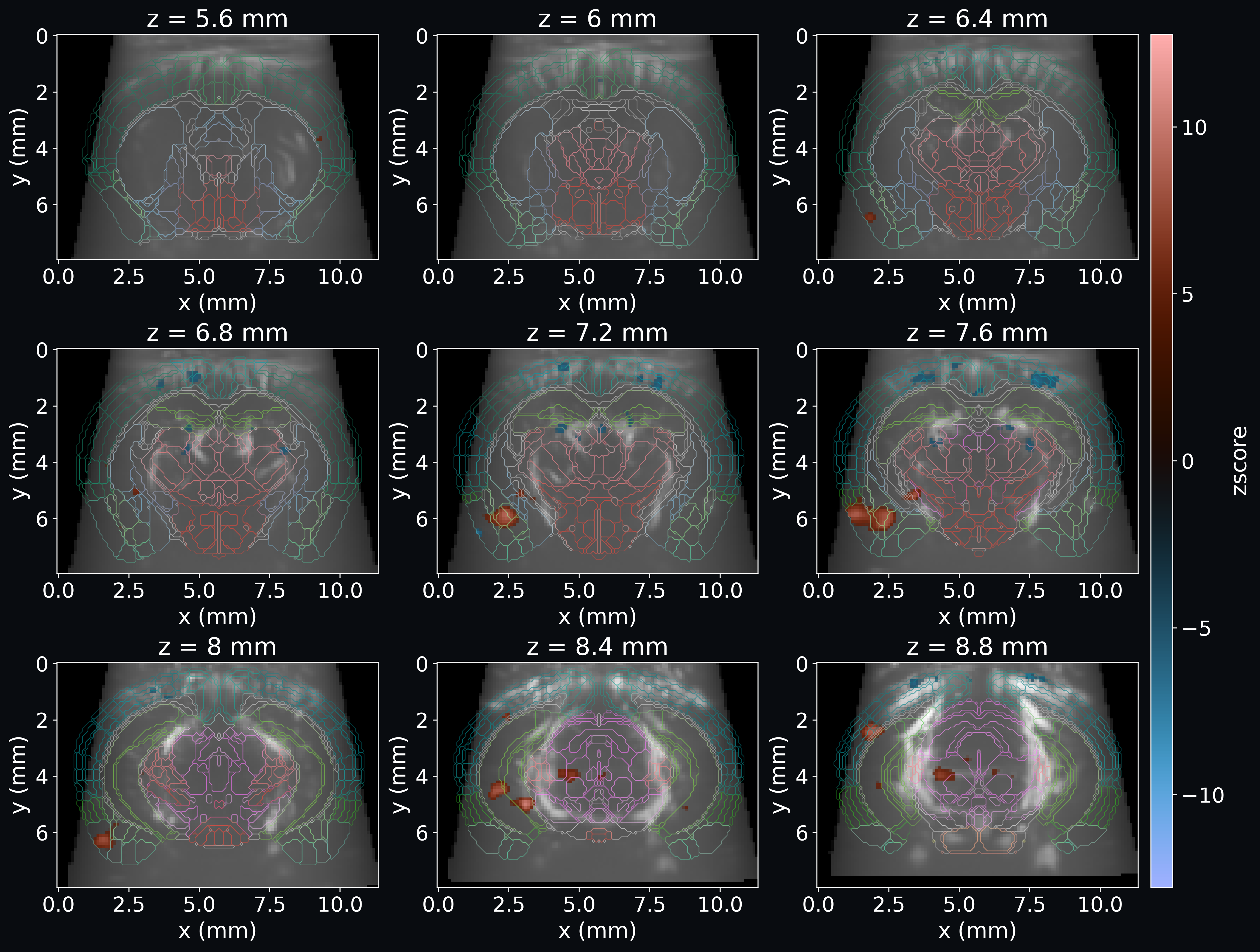 First-level GLM analysis of fUSI data