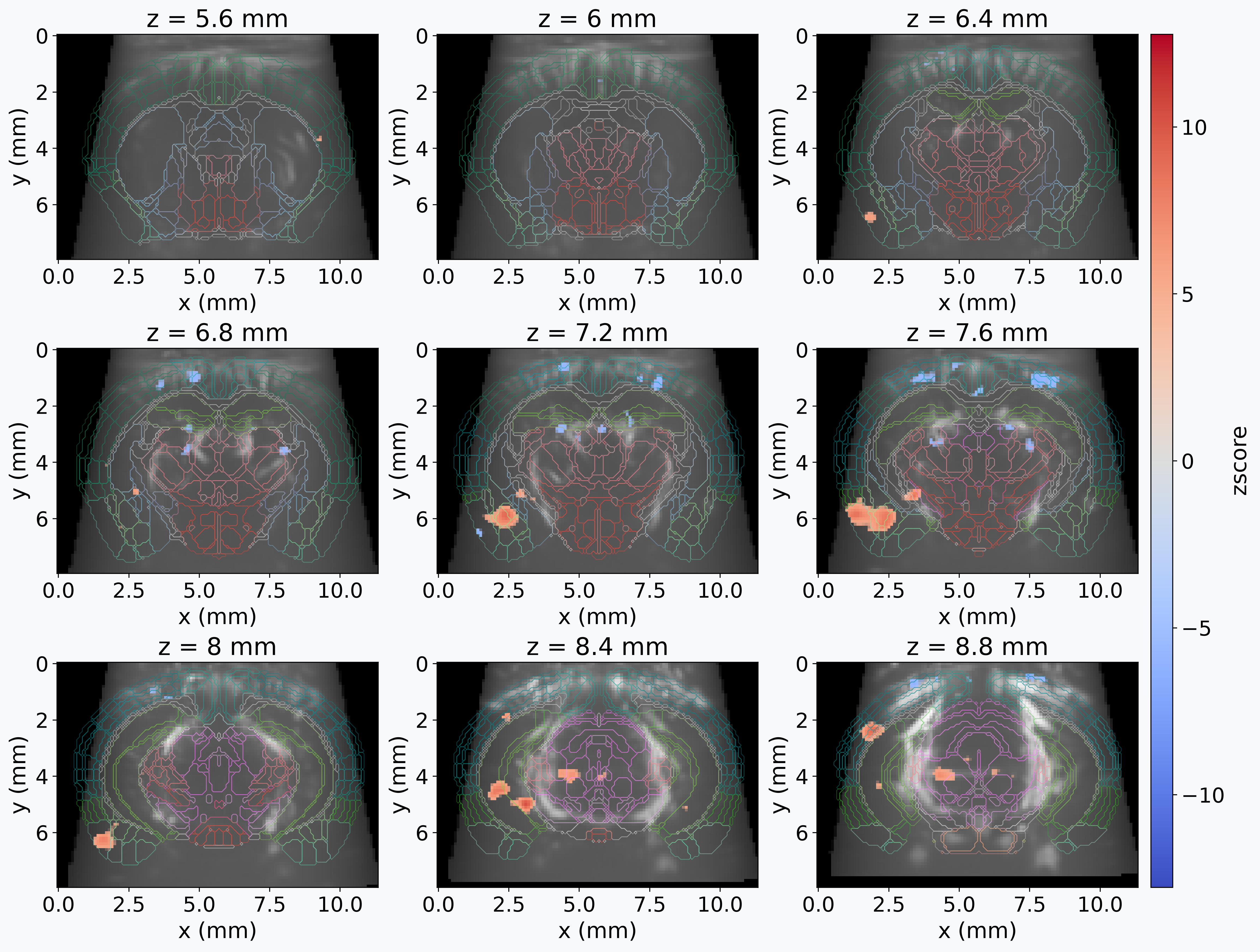 First-level GLM analysis of fUSI data