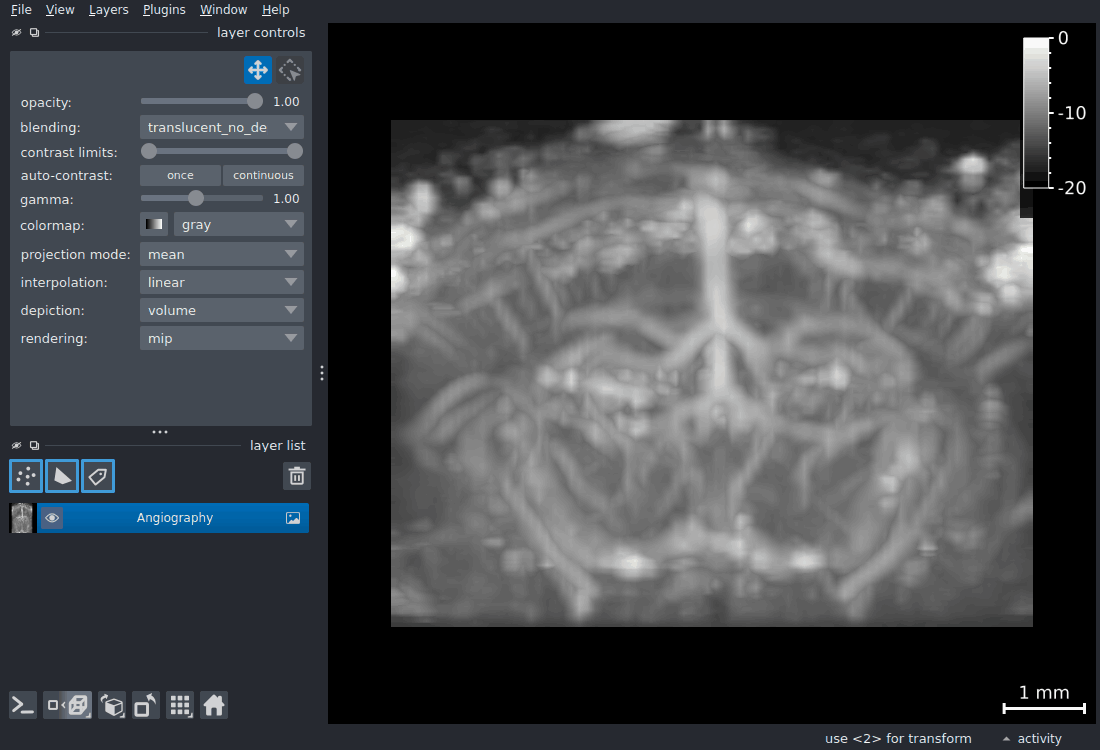 3D orbit of the angiography volume