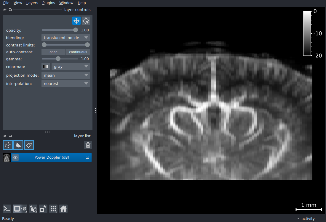 napari viewer with a 2D+t power Doppler dataset