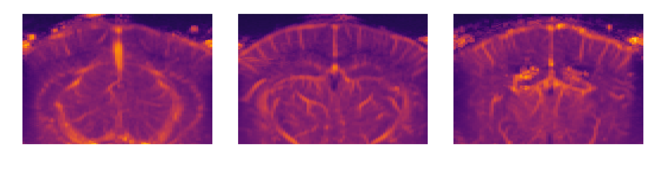 Three selected elevation slices of the angiography volume
