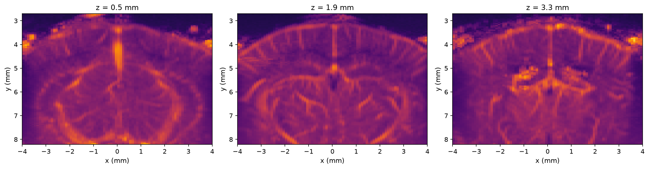 Three selected elevation slices of the angiography volume