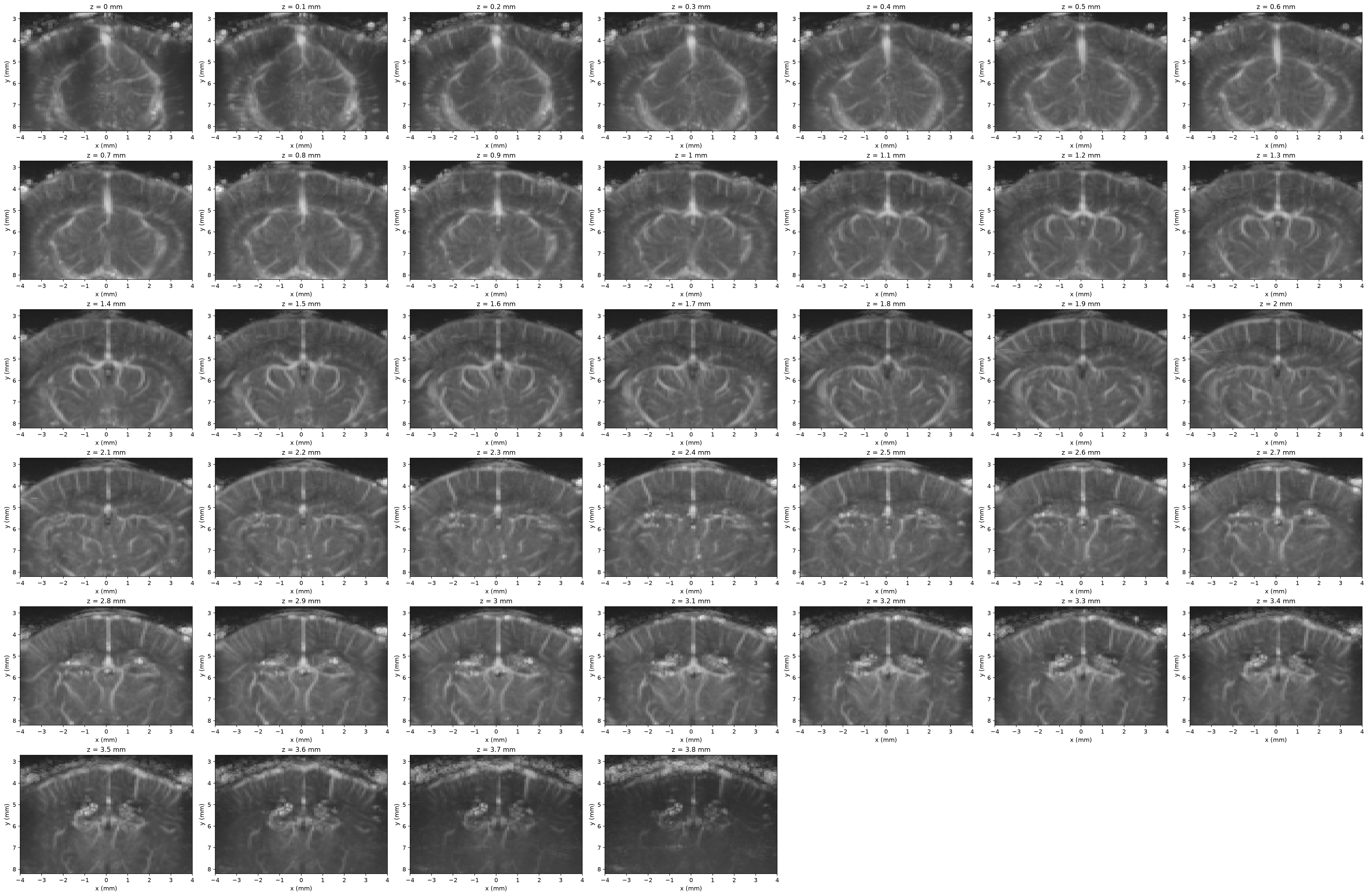 3D angiography volume shown as an elevation-slice grid
