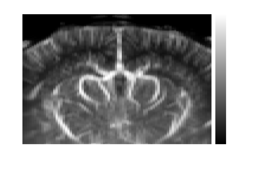 Mean power Doppler volume