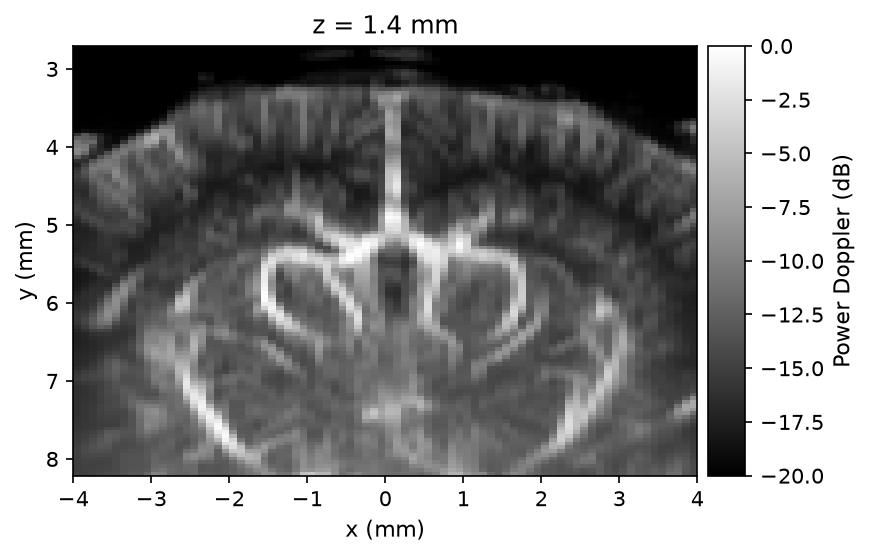 Mean power Doppler volume