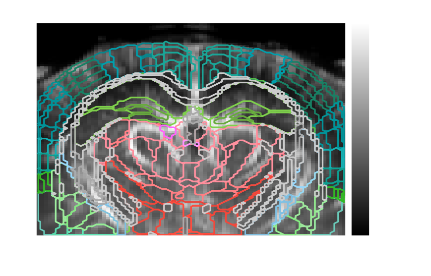 Power Doppler volume with Allen atlas region contours overlaid
