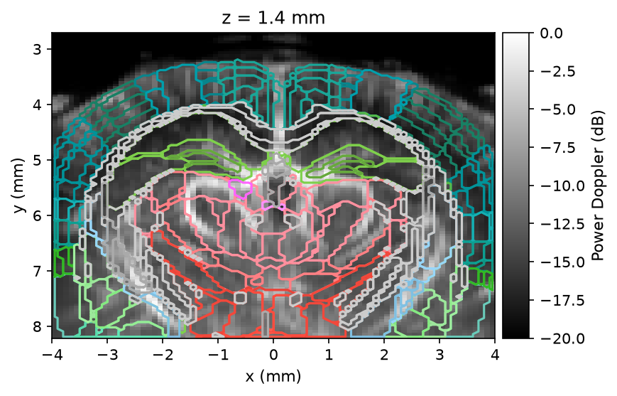 Power Doppler volume with Allen atlas region contours overlaid