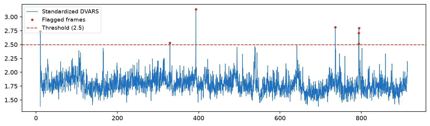 DVARS time series with threshold