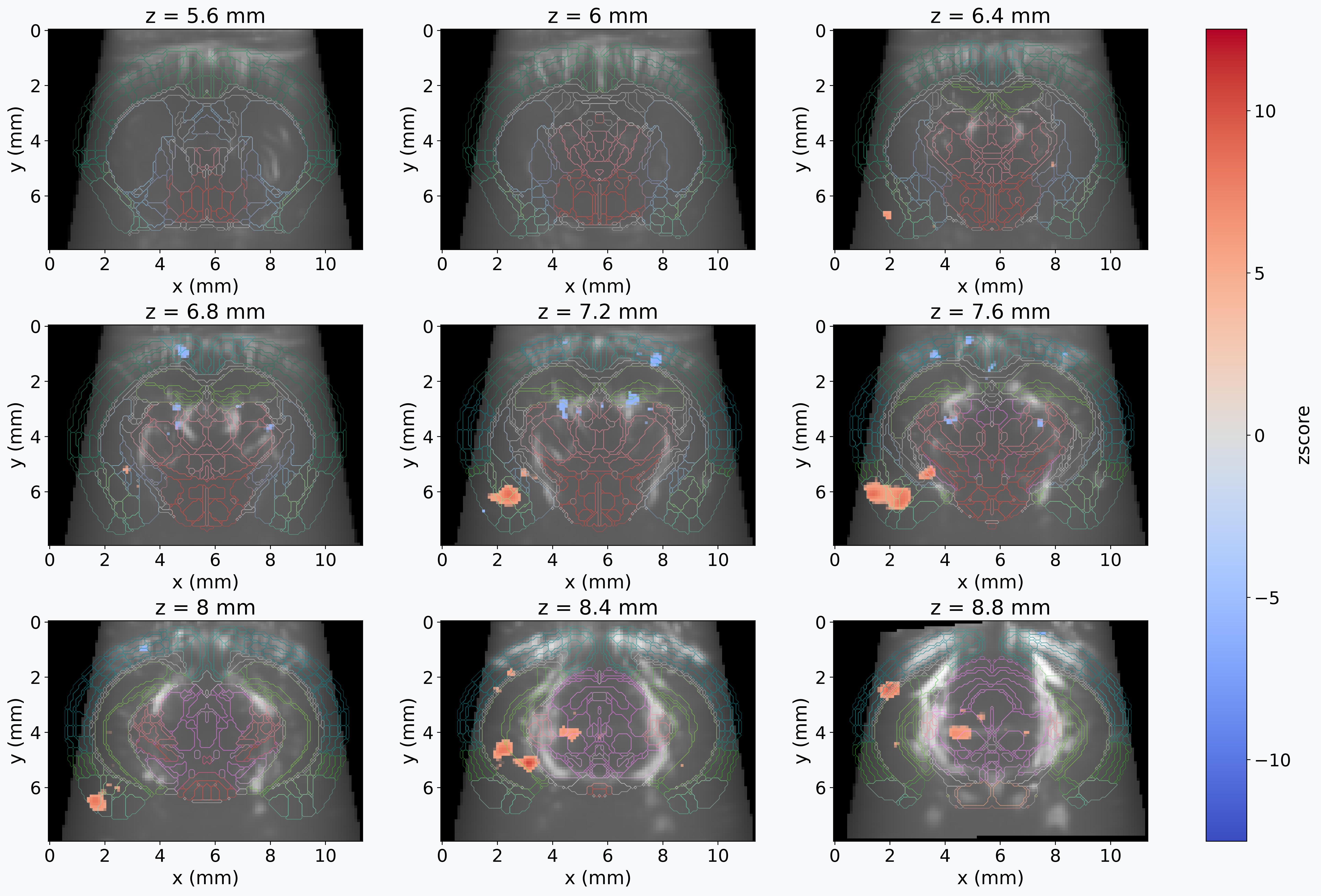 First-level GLM analysis of fUSI data
