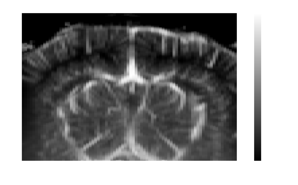 Mean power Doppler in dB