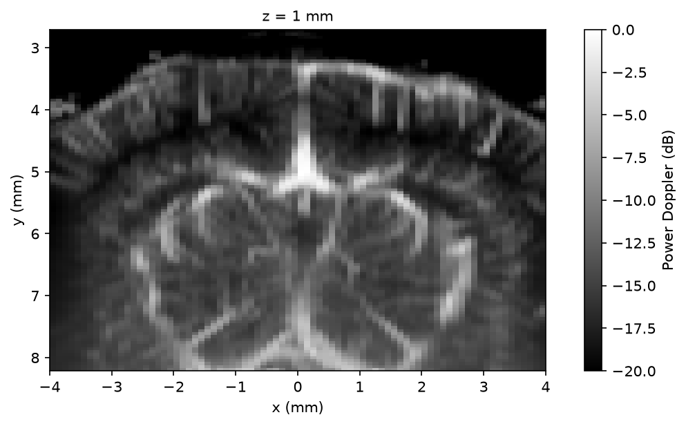 Mean power Doppler in dB