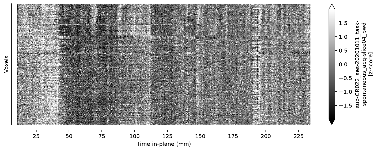 Carpet plot of power Doppler voxel time-series