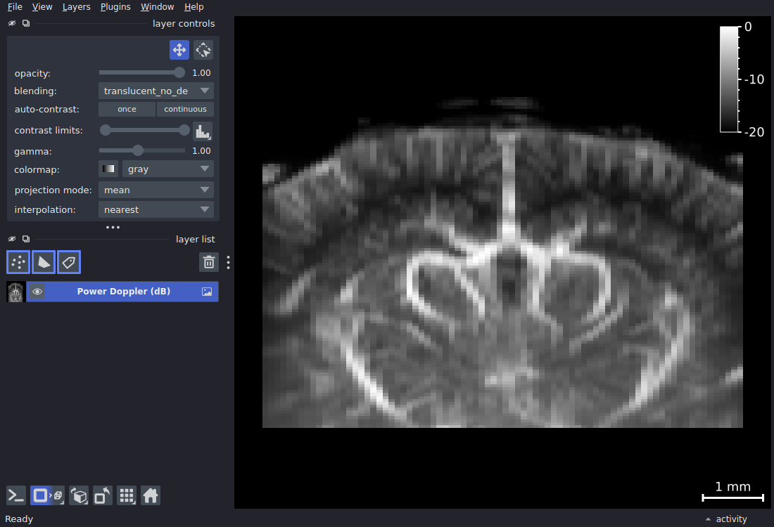 napari viewer with a 2D+t power Doppler dataset