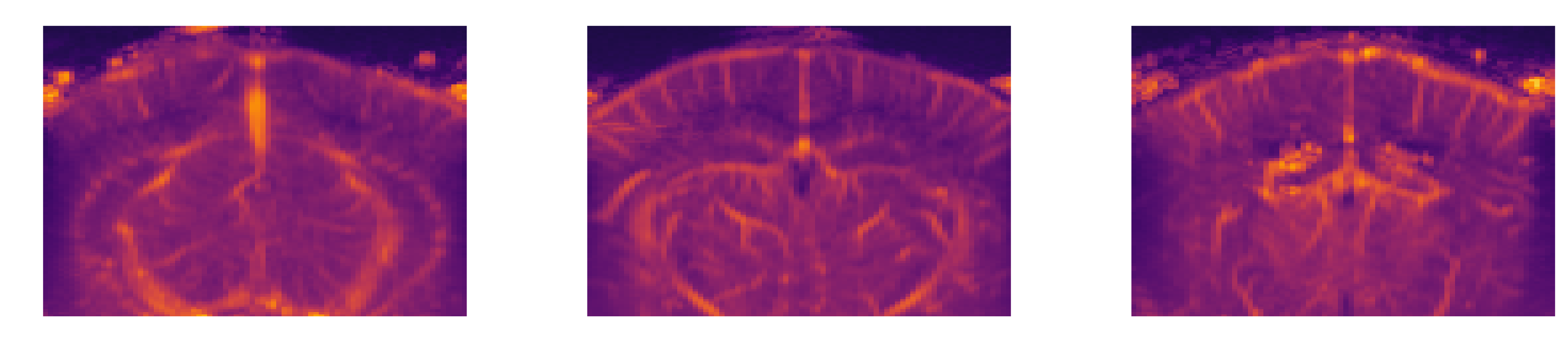 Three selected elevation slices of the angiography volume
