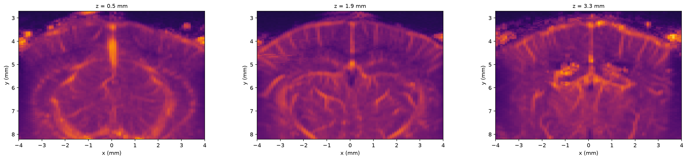 Three selected elevation slices of the angiography volume