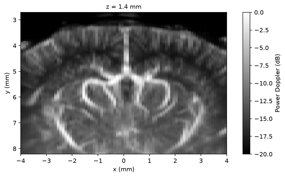 Mean power Doppler volume