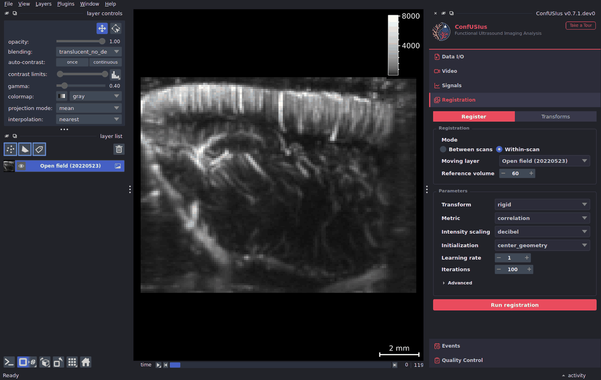 ConfUSIus Registration panel — within-scan motion correction