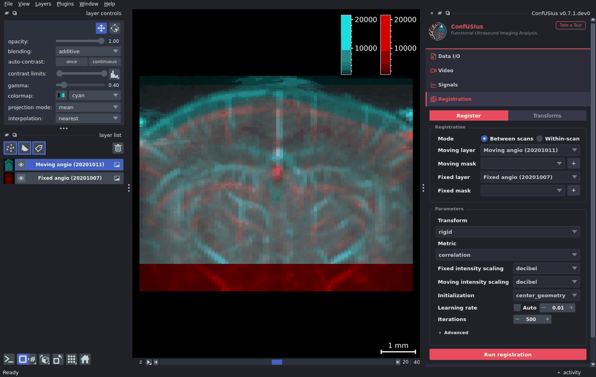 ConfUSIus Registration panel — rigid between-session angiography run