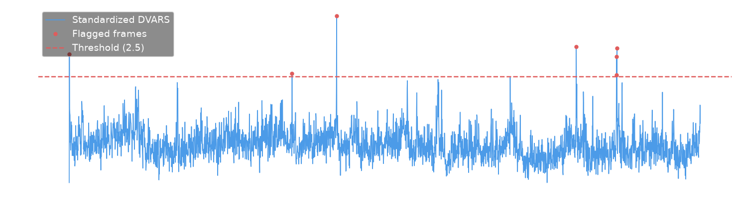 DVARS time series with threshold